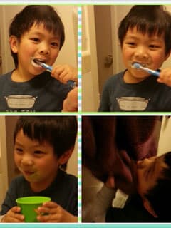 保護小乳齒(上)
