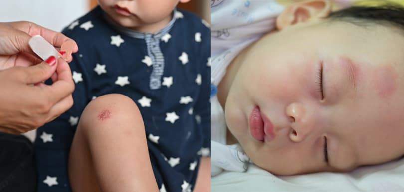 親子英語教室#1：小孩受傷了，英文怎麼說？受傷不要只會說I got hurt！