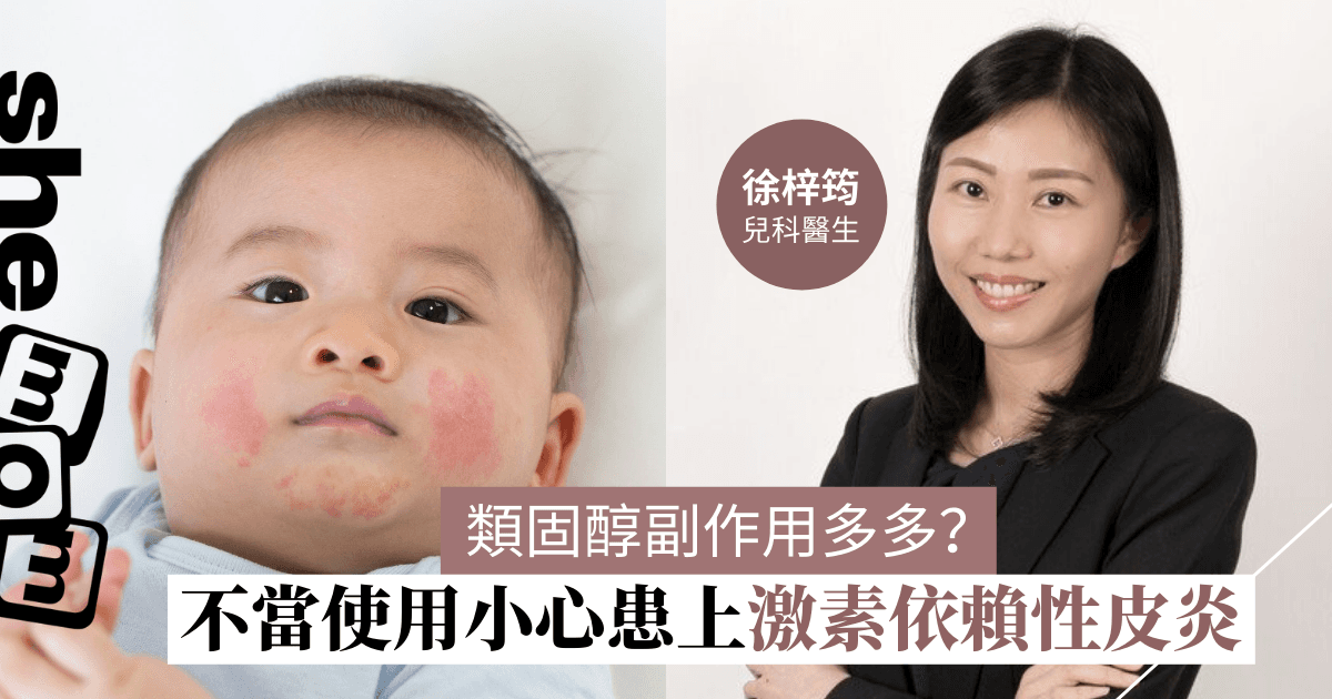 類固醇副作用多多？ 不當使用小心患上激素依賴性皮炎 | 徐梓筠兒科醫生