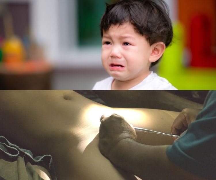男童包皮過長點處理？如何決定是否要做手術？｜外科專科醫生劉湛益