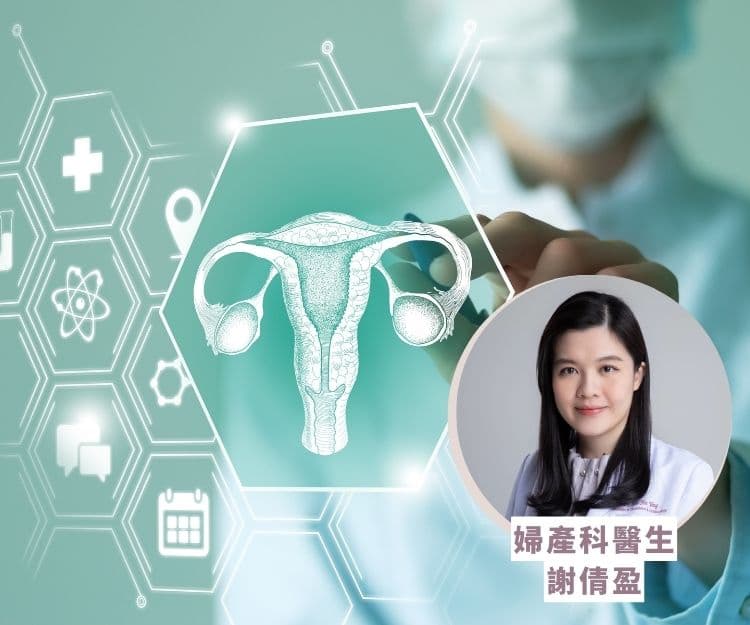 朱古力瘤｜常見女性病「朱古力瘤」影響生育？婦產科醫生提供4個方法減輕症狀患者也可安全生育健康寶寶