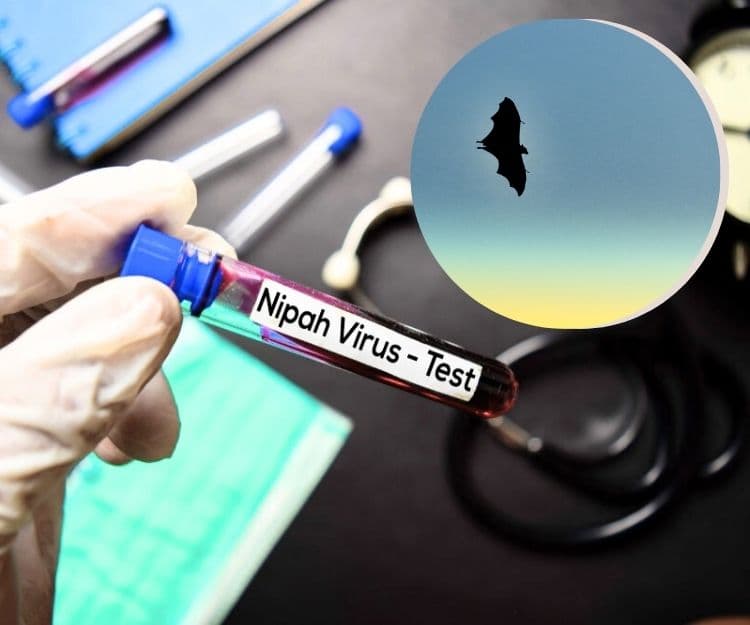 尼帕病毒死亡率達75%！人人自危再現口罩搶購潮！一文睇清尼帕病毒病徵及5大預防方法