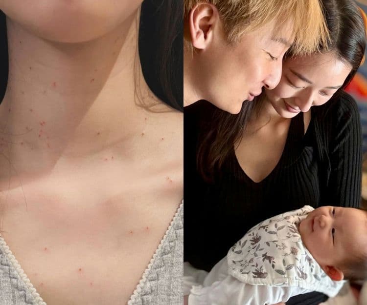 BB常見傳染病｜方力申太太做一事避免病毒傳染BB！初生BB常見4大傳染病病徵及治療方法