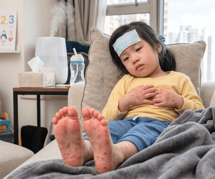 手足口病爆發 酒精完全無用 中醫爸爸分享2招提升孩子自身免疫力 降低感染風險