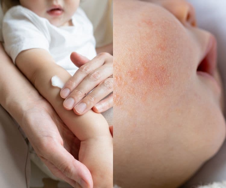 消委會嬰幼兒潤膚乳|測試40款產品過半數樣本含致敏物質!12款獲5星高評分 最平只需$29.9