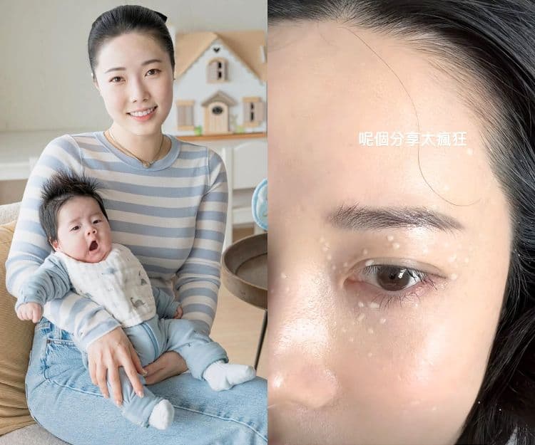 網紅媽媽Sue Chang分享泵奶血淚史!公開人奶噴射片段 網民斥「嘥奶」 母乳媽媽必知!4招乳頭保養及修護