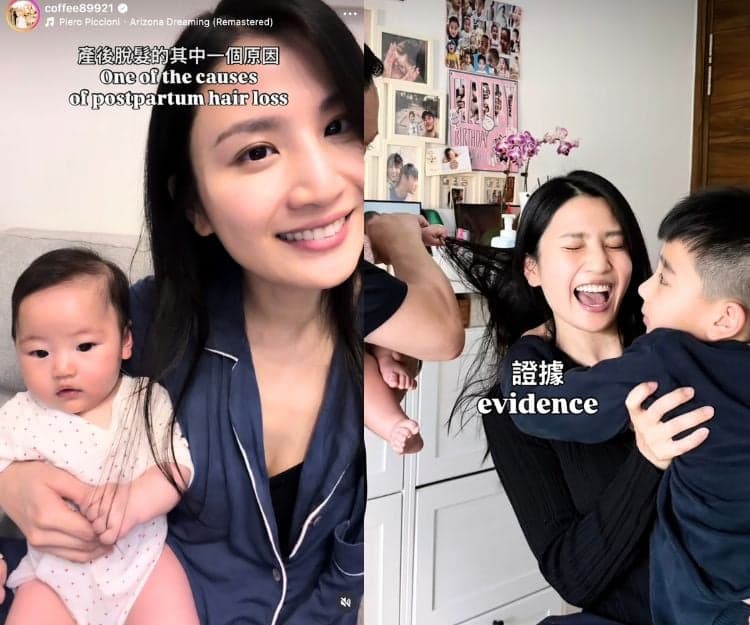產後脫髮|Coffee林芊妤公開「脫髮」真相?中醫拆解3成婦女中招原因:必試生髮食療!編輯推介4款防脫髮好物