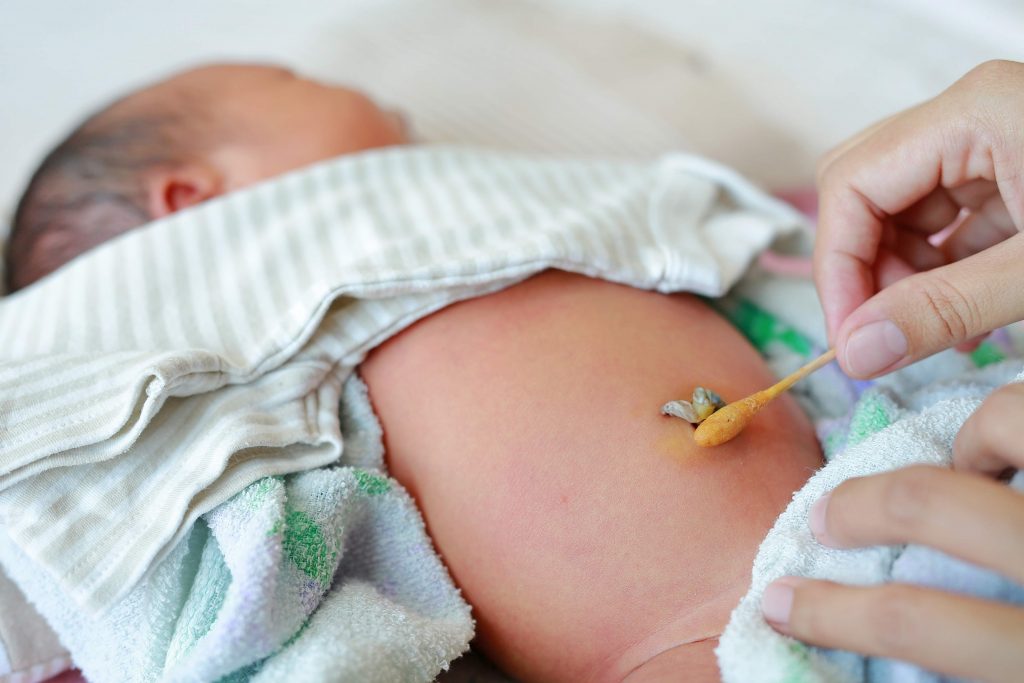 新手媽煩惱，產後如何護理嬰兒臍帶？