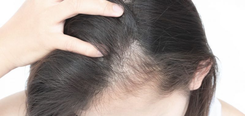 護髮專家分享 6 個護髮養髮心得