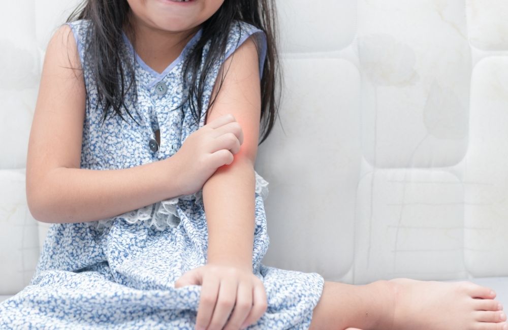 中醫治濕疹：成人兒童濕疹應對方法與濕疹食療｜註冊中醫師關証顥